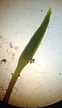 Developing sporophyte tip, low power