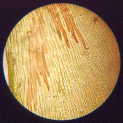 Moss leaf cells