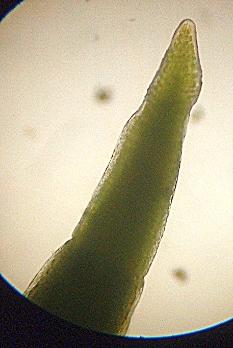 Developing sporophyte tip, medium power