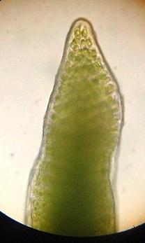Developing sporophyte tip, high power