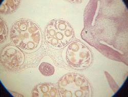 Chrsanthemum pollen in section