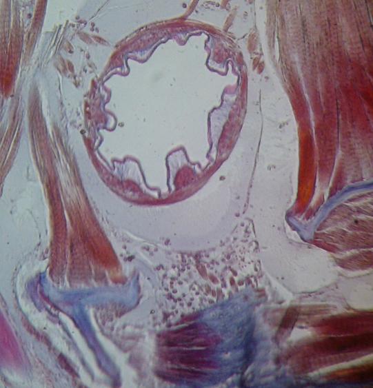 millipede gut
